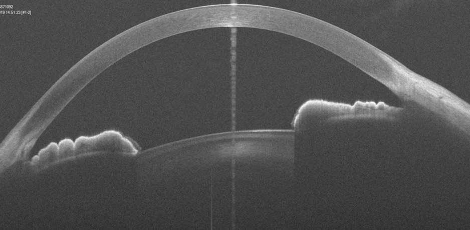 ultrasound advanced ophthalmologic diagnostic device