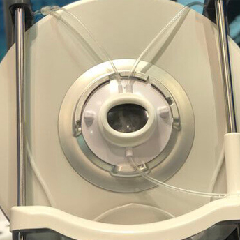 advanced ophthalmologic diagnostic device